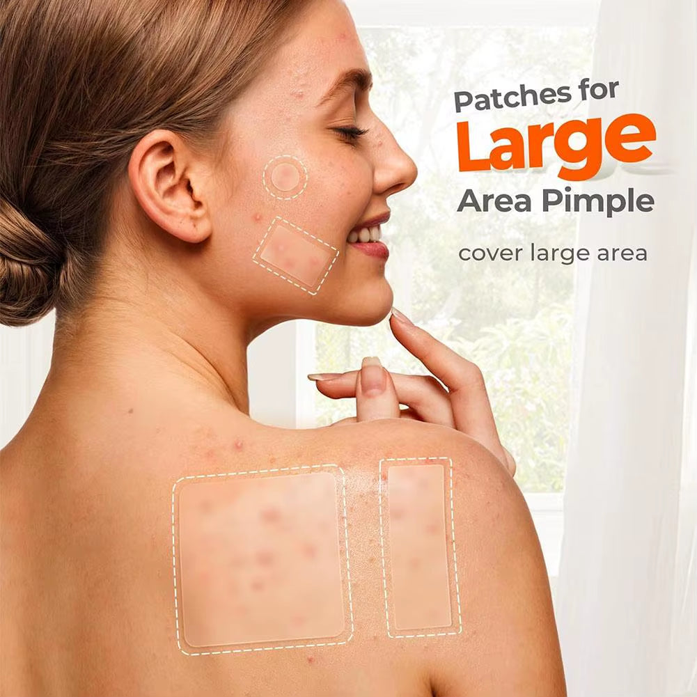 Hydrocolloid pimple patches packaging